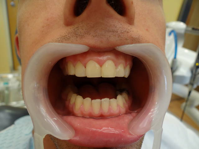 dr huszár ernő fogorvos miskolc university
